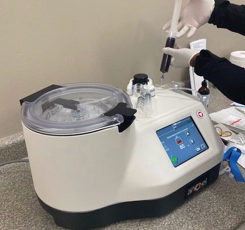 medical centrifuge machine on a countertop. The machine has a digital display