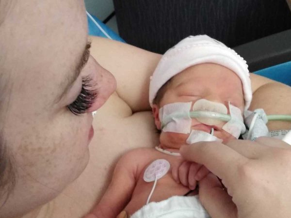 the infant in a pink hat connected to medical tubes. As she gently holds the babys tiny hand